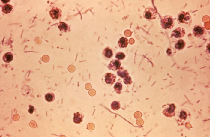 Soubor:Shigella stool.jpg