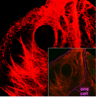 Mikroskopická keratinová vlákna uvnitř buněk