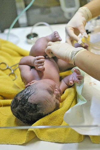 Soubor:Umbilical-newborn.jpg