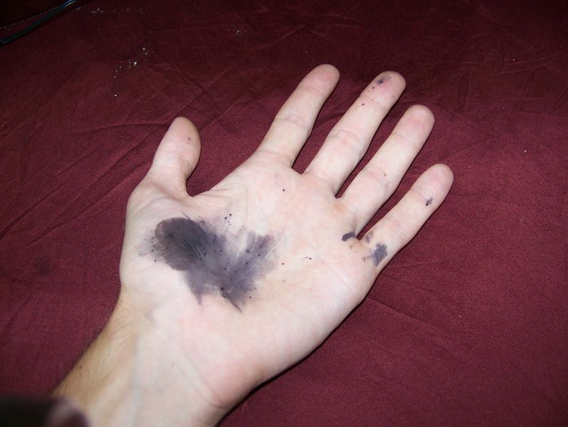 Soubor:Silver nitrate stains.jpg