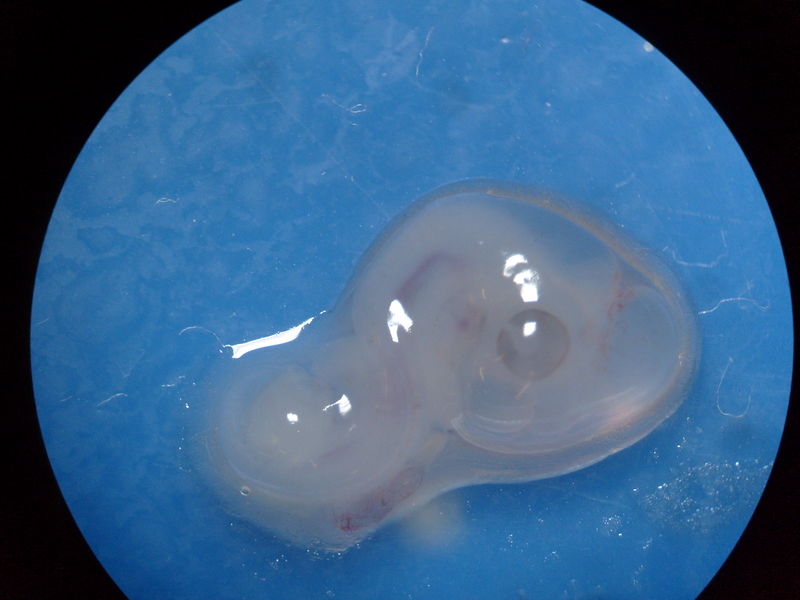 Soubor:Chicken-embryo-4days old-stereomicroscope.jpg