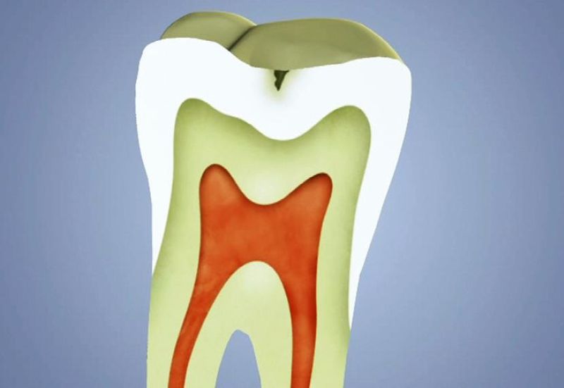 Soubor:Zubni kaz1.jpg