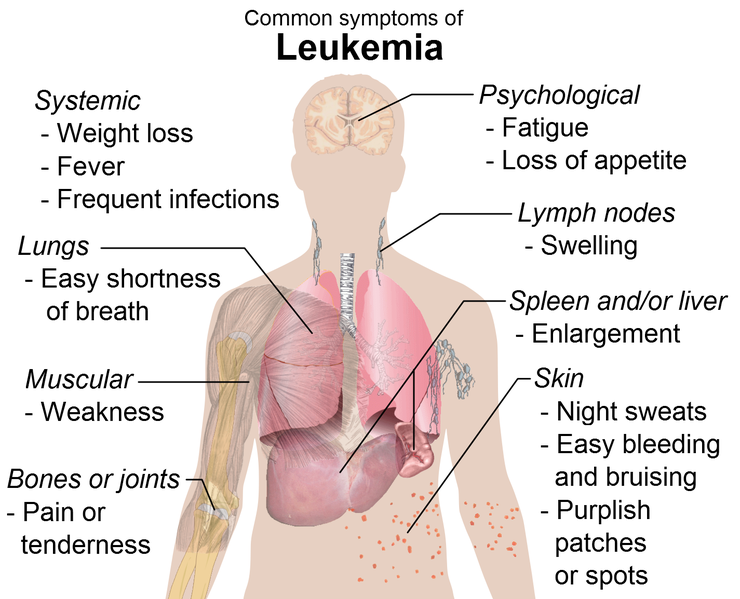 Soubor:Symptoms of leukemia.png