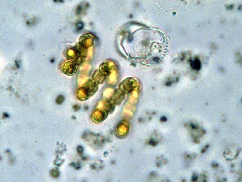 Soubor:Anabaenaspiroides EPA.jpg