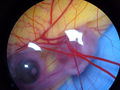 Chicken-embryo-1week old-stereomicroscope.jpg