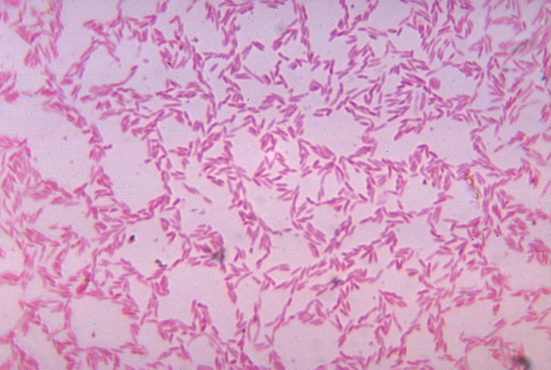 Soubor:Bacteroides biacutis 01.jpg