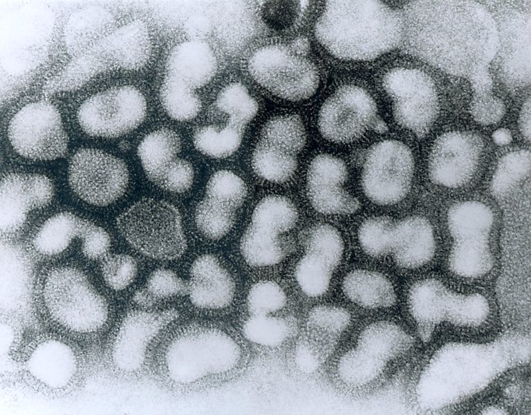 Soubor:Influenza A - late passage.jpg
