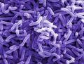 Cholera bacteria (Vibrio cholerae)-Flickr.jpg