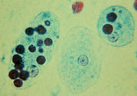 Trophozoites of Entamoeba histolytica with ingested erythrocytes.JPG