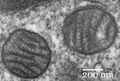 Mitochondria, mammalian lung - TEM (2).jpg