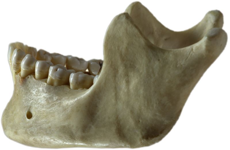 Soubor:Human jawbone left.jpg