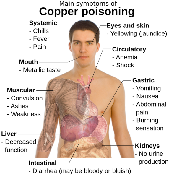 Soubor:Main symptoms of copper poisoning.png